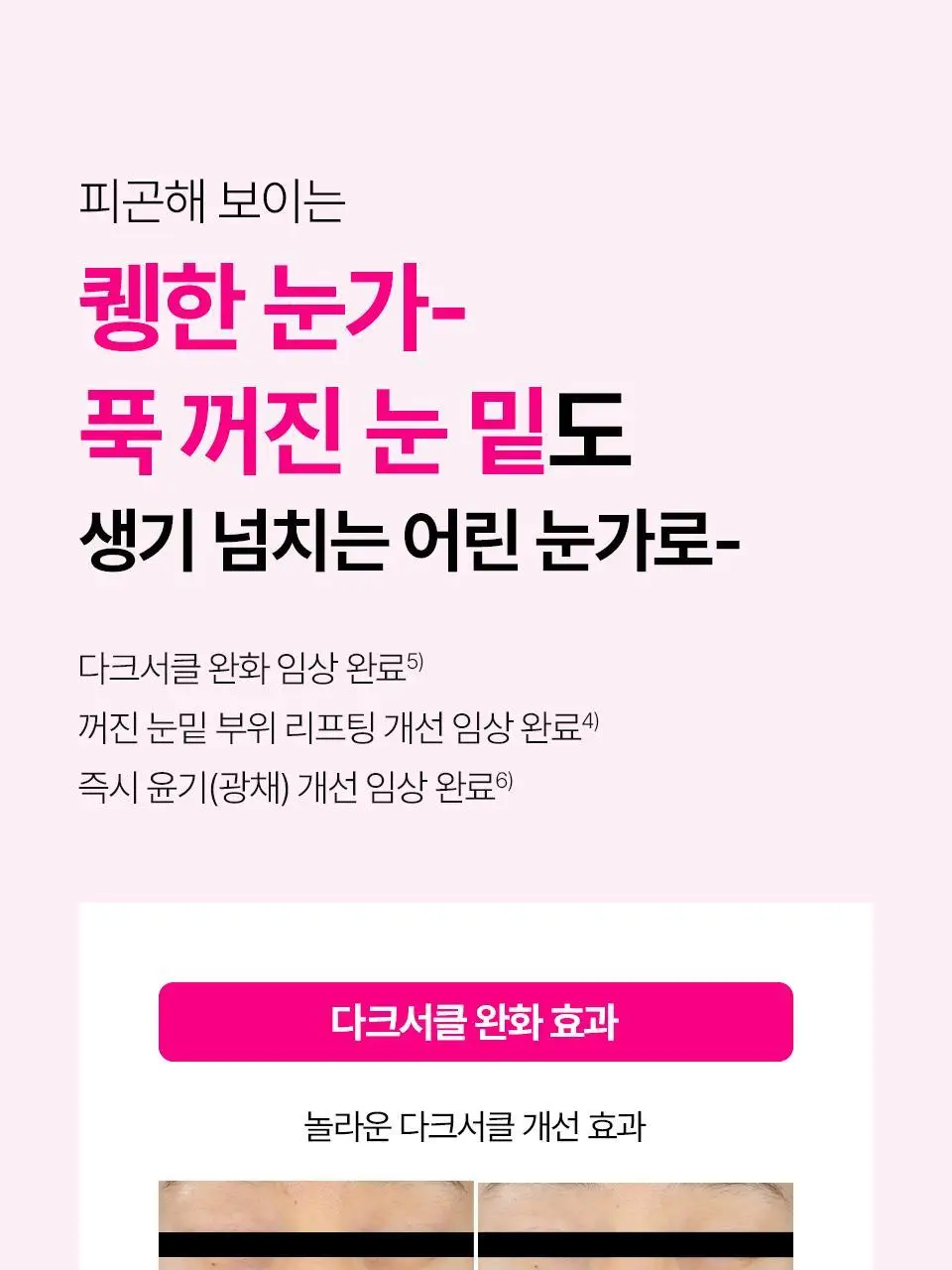 [퀭한눈가패치/키짱PICK] 아이소이 블레미쉬 케어 아이&미간 패치 90매 상세페이지 13